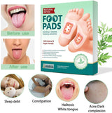 SS MART™ Premium Detox Foot Patches (Pack of 10) – Buy 1 Get 1 Free