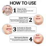 Premium Skin Tag Removal Patch – Soft on Skin, Tough on Tags 💎 BUY 1 GET 1 FREE