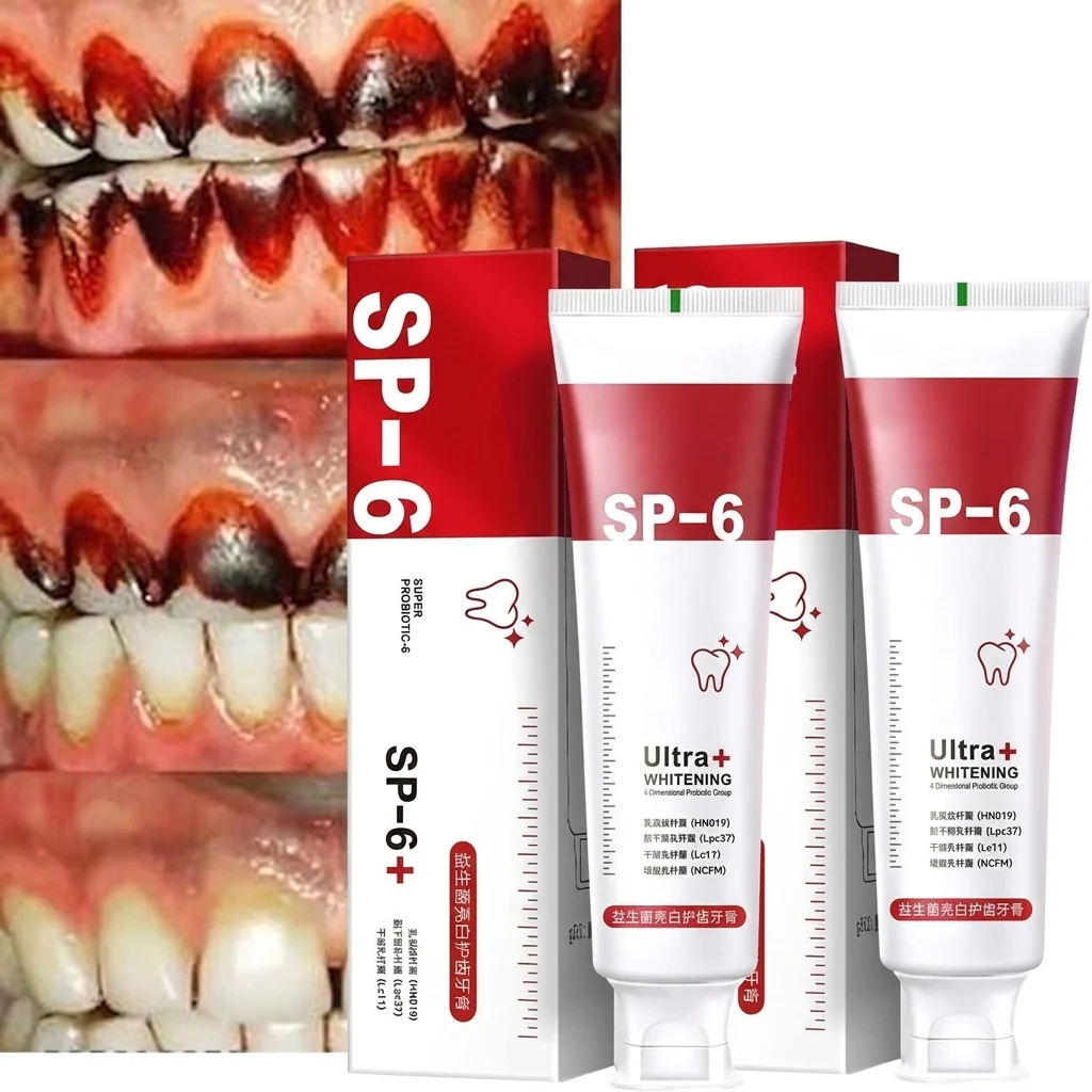 🦷 SP-6 Whitening Toothpaste | Probiotic Teeth Whitening for Stains, Bad Breath & Gum Health- ( Pack of 2)